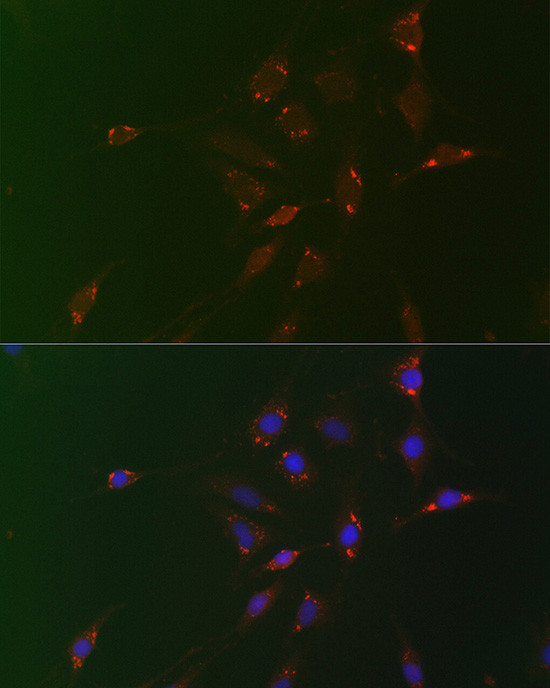 ADFP Antibody in Immunocytochemistry (ICC/IF)