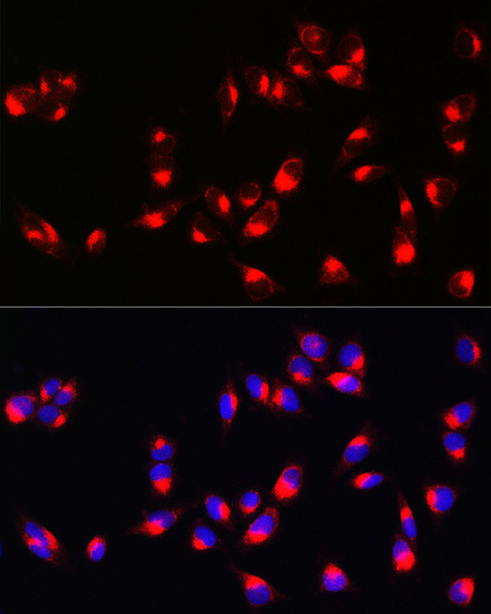 Melan-A Antibody in Immunocytochemistry (ICC/IF)