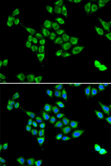 Pyruvate Carboxylase Antibody in Immunocytochemistry (ICC/IF)