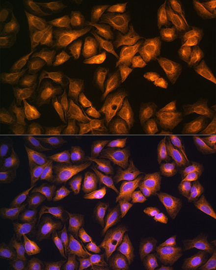 SOAT1 Antibody in Immunocytochemistry (ICC/IF)