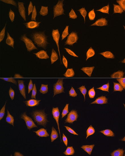 SOAT1 Antibody in Immunocytochemistry (ICC/IF)