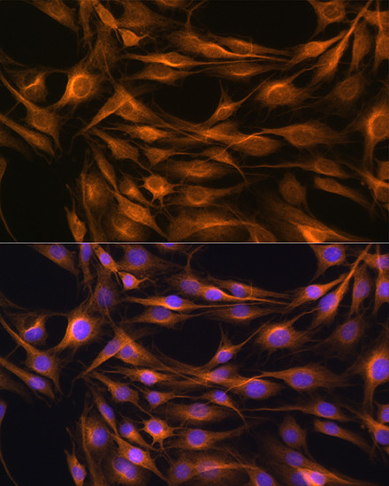 SOAT1 Antibody in Immunocytochemistry (ICC/IF)