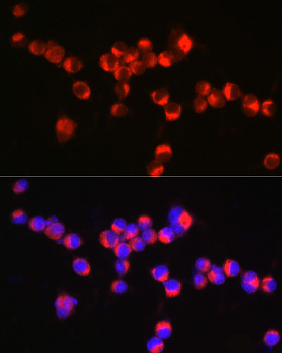 Synaptophysin Antibody in Immunocytochemistry (ICC/IF)