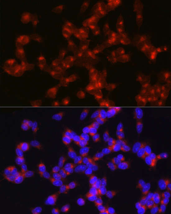 Synaptophysin Antibody in Immunocytochemistry (ICC/IF)