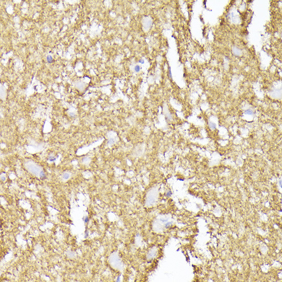 Synaptophysin Antibody in Immunohistochemistry (Paraffin) (IHC (P))