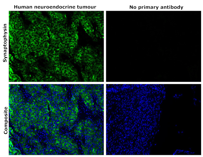 Synaptophysin Antibody in Immunohistochemistry (Paraffin) (IHC (P))