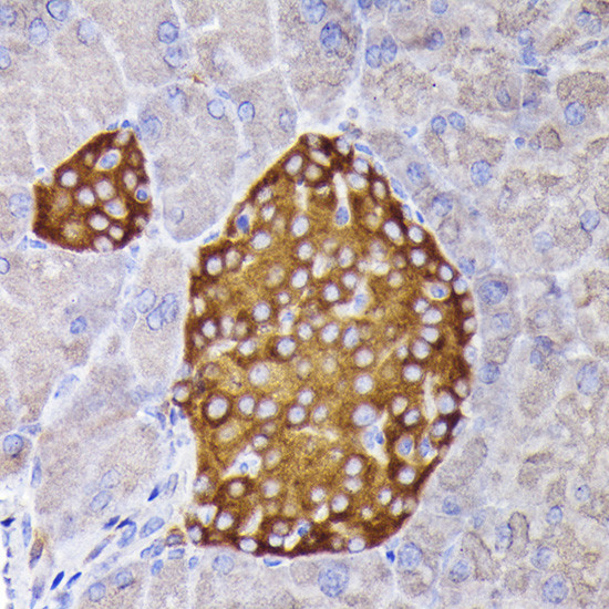 Synaptophysin Antibody in Immunohistochemistry (Paraffin) (IHC (P))