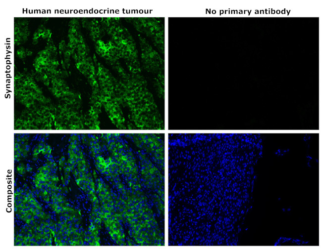 Synaptophysin Antibody in Immunohistochemistry (Paraffin) (IHC (P))