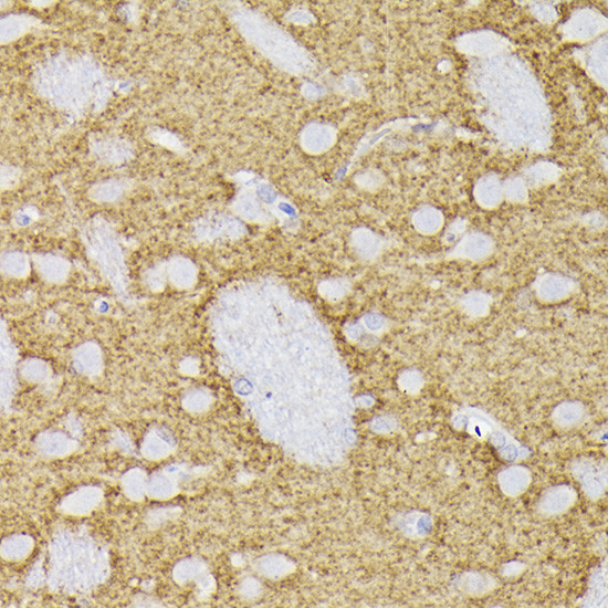 Synaptophysin Antibody in Immunohistochemistry (Paraffin) (IHC (P))