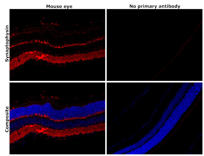 Synaptophysin Antibody in Immunohistochemistry (Paraffin) (IHC (P))