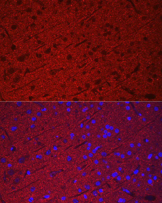 Synaptophysin Antibody in Immunohistochemistry (Paraffin) (IHC (P))