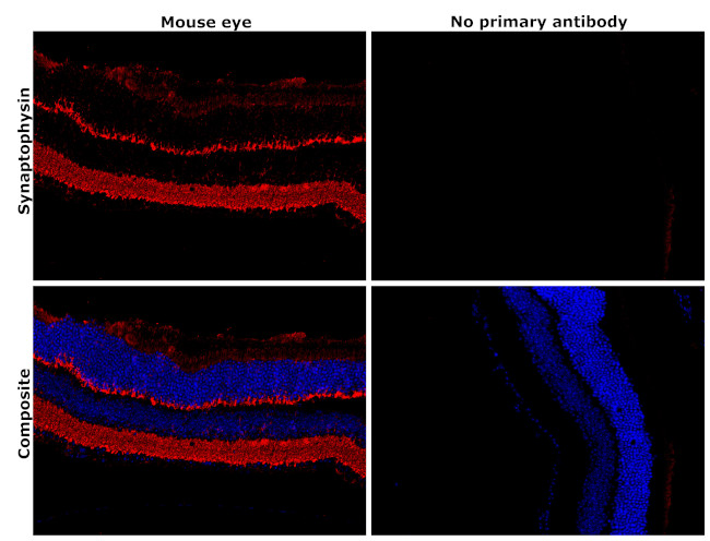 Synaptophysin Antibody in Immunohistochemistry (Paraffin) (IHC (P))