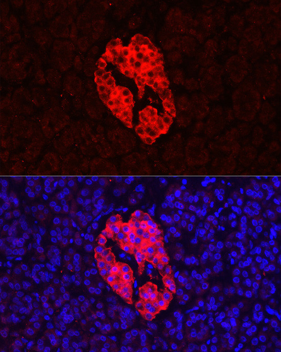 Synaptophysin Antibody in Immunohistochemistry (Paraffin) (IHC (P))