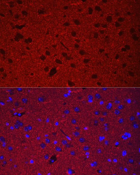 Synaptophysin Antibody in Immunohistochemistry (Paraffin) (IHC (P))