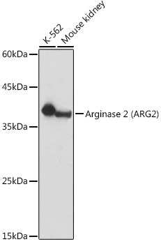 Arginase 2 Antibody in Western Blot (WB)