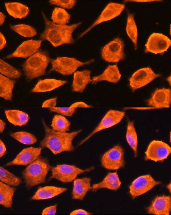 DTYMK Antibody in Immunocytochemistry (ICC/IF)