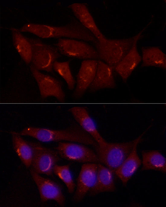 GRP Antibody in Immunocytochemistry (ICC/IF)