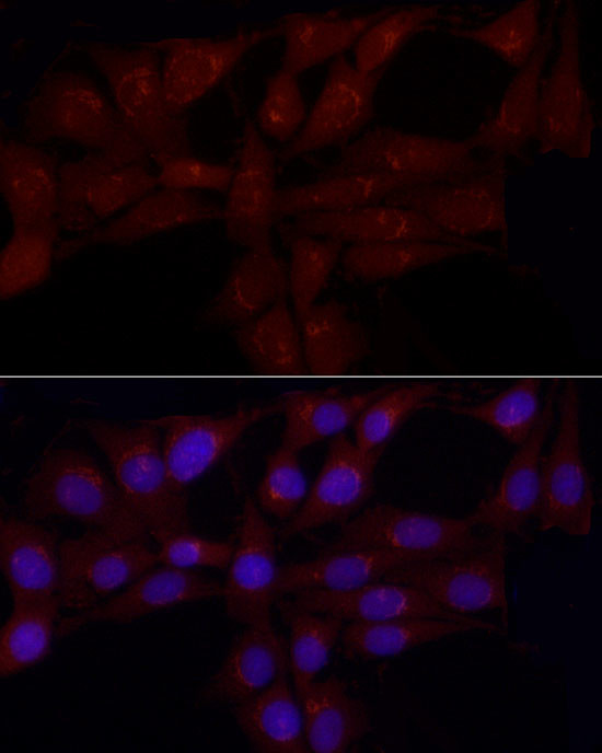 GRP Antibody in Immunocytochemistry (ICC/IF)