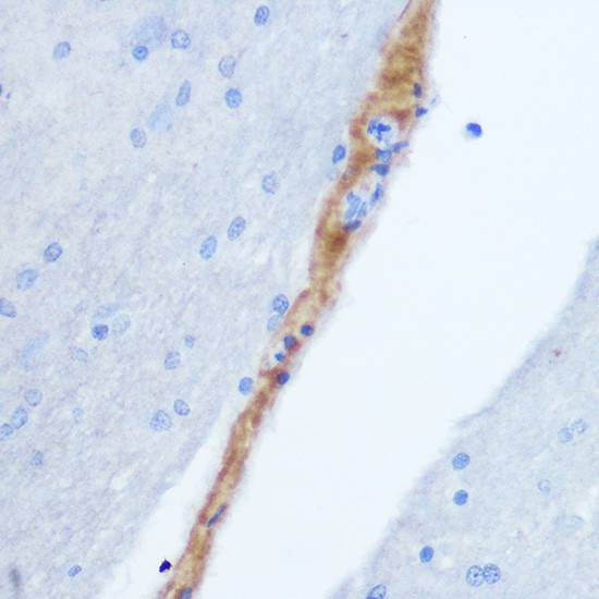 GRP Antibody in Immunohistochemistry (Paraffin) (IHC (P))