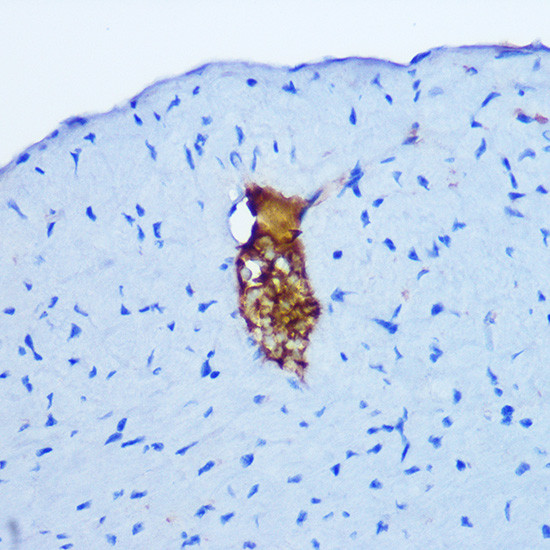 GRP Antibody in Immunohistochemistry (Paraffin) (IHC (P))