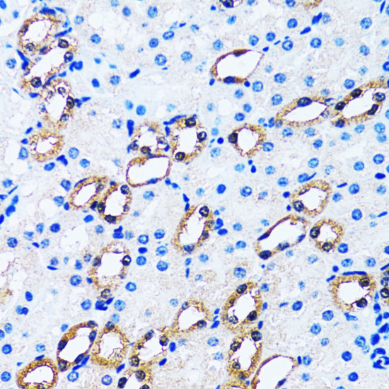 IMPA1 Antibody in Immunohistochemistry (Paraffin) (IHC (P))