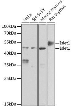 ISL1 Antibody in Western Blot (WB)