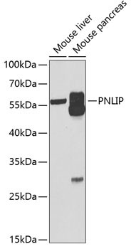 PNLIP Antibody in Western Blot (WB)