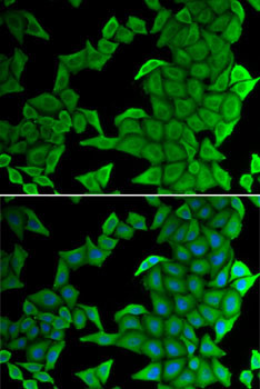 SMYD2 Antibody in Immunocytochemistry (ICC/IF)