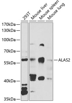 ALAS2 Antibody in Western Blot (WB)