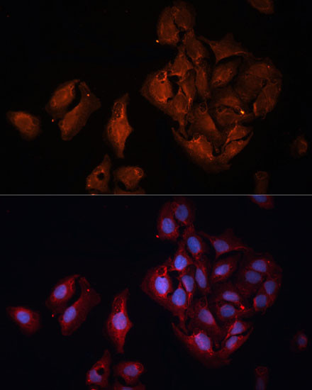 BAP1 Antibody in Immunocytochemistry (ICC/IF)