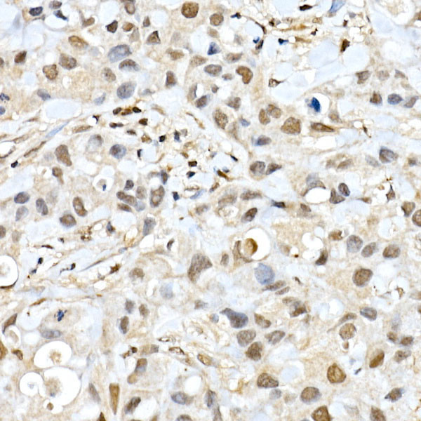 BAP1 Antibody in Immunohistochemistry (Paraffin) (IHC (P))