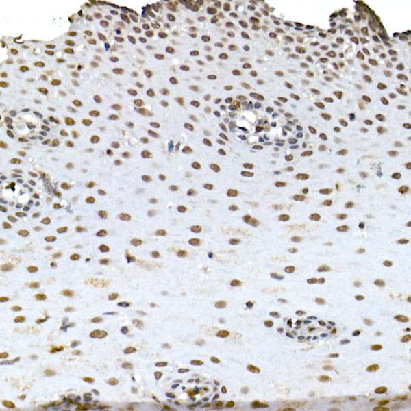 BAP1 Antibody in Immunohistochemistry (Paraffin) (IHC (P))