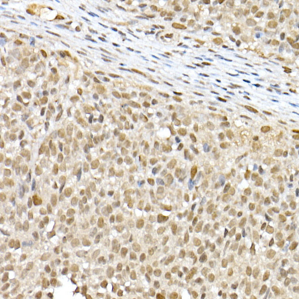 BAP1 Antibody in Immunohistochemistry (Paraffin) (IHC (P))