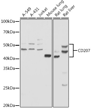 CD207 (Langerin) Antibody in Western Blot (WB)