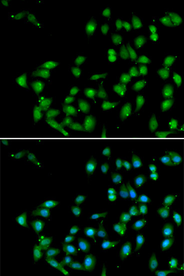 CTNNBL1 Antibody in Immunocytochemistry (ICC/IF)