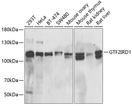 GTF2IRD1 Antibody in Western Blot (WB)