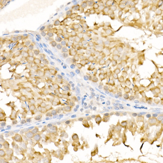 KIF3A Antibody in Immunohistochemistry (Paraffin) (IHC (P))