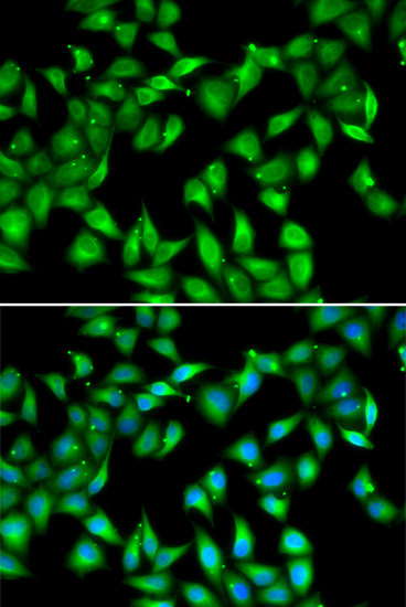 MYL3 Antibody in Immunocytochemistry (ICC/IF)