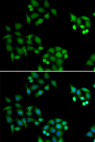 NSFL1C Antibody in Immunocytochemistry (ICC/IF)