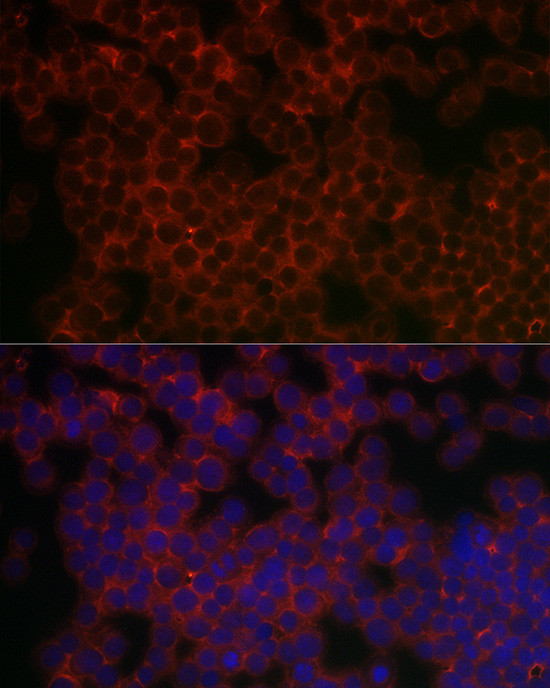 PIK3CG Antibody in Immunocytochemistry (ICC/IF)