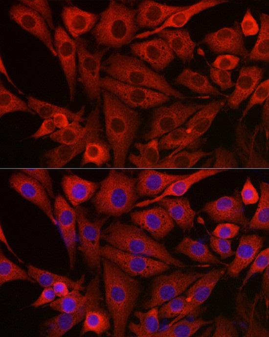 PIK3CG Antibody in Immunocytochemistry (ICC/IF)