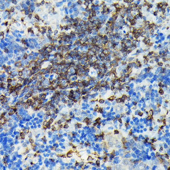 PIK3CG Antibody in Immunohistochemistry (Paraffin) (IHC (P))