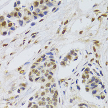 PPP1R8 Antibody in Immunohistochemistry (Paraffin) (IHC (P))