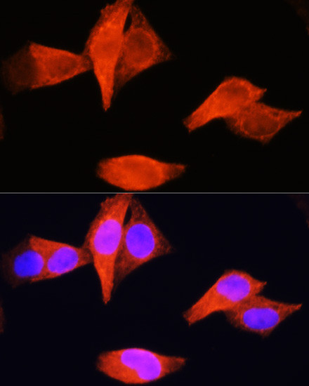 PSAT1 Antibody in Immunocytochemistry (ICC/IF)