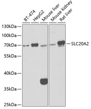 SLC20A2 Antibody in Western Blot (WB)