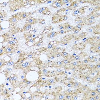 Sorcin Antibody in Immunohistochemistry (Paraffin) (IHC (P))