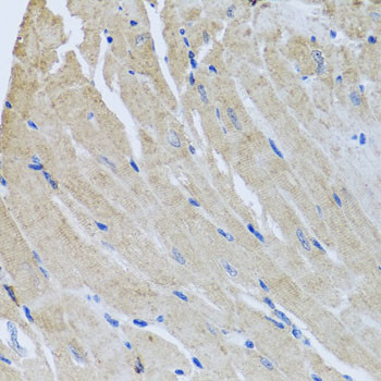 Sorcin Antibody in Immunohistochemistry (Paraffin) (IHC (P))