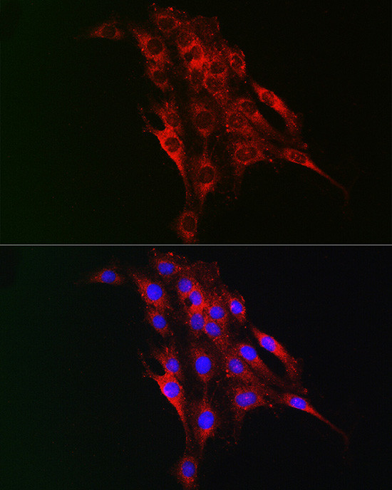 TAGLN2 Antibody in Immunocytochemistry (ICC/IF)