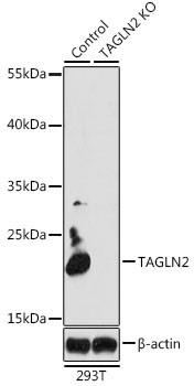 TAGLN2 Antibody in Western Blot (WB)