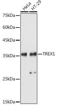 TREX1 Antibody in Western Blot (WB)